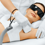 Laser Hair Removal - Underarms and Arms Hair